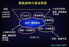 脳性麻痺 肢体不自由児マッサージ 有限会社健生メディカルコーポレーション